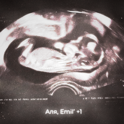 Аля,Emil' - +1