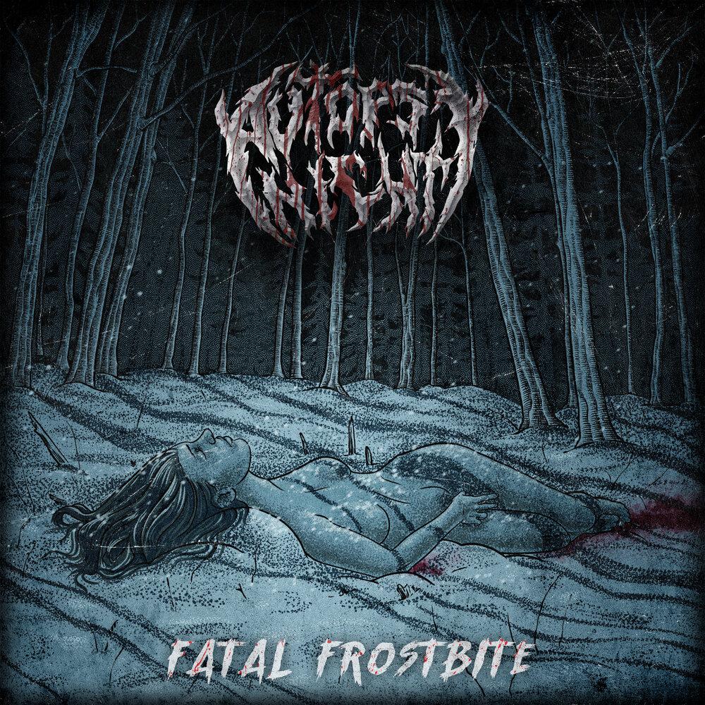 Fatal frostbite - Autopsy Night