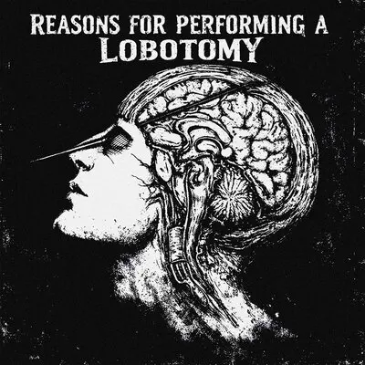 10 reason lobotomy - KALXSH