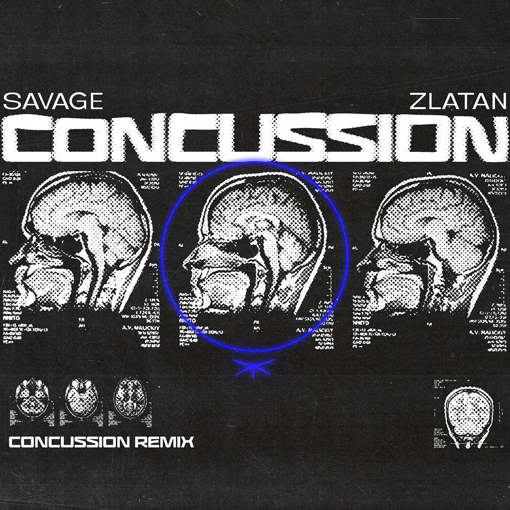 Concussion (Remix) - Savage & Zlatan