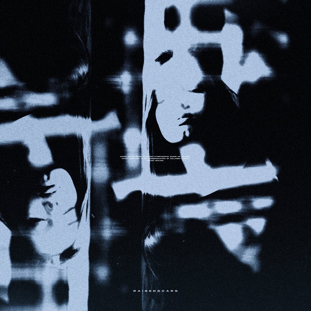 shxpe - raisedscars