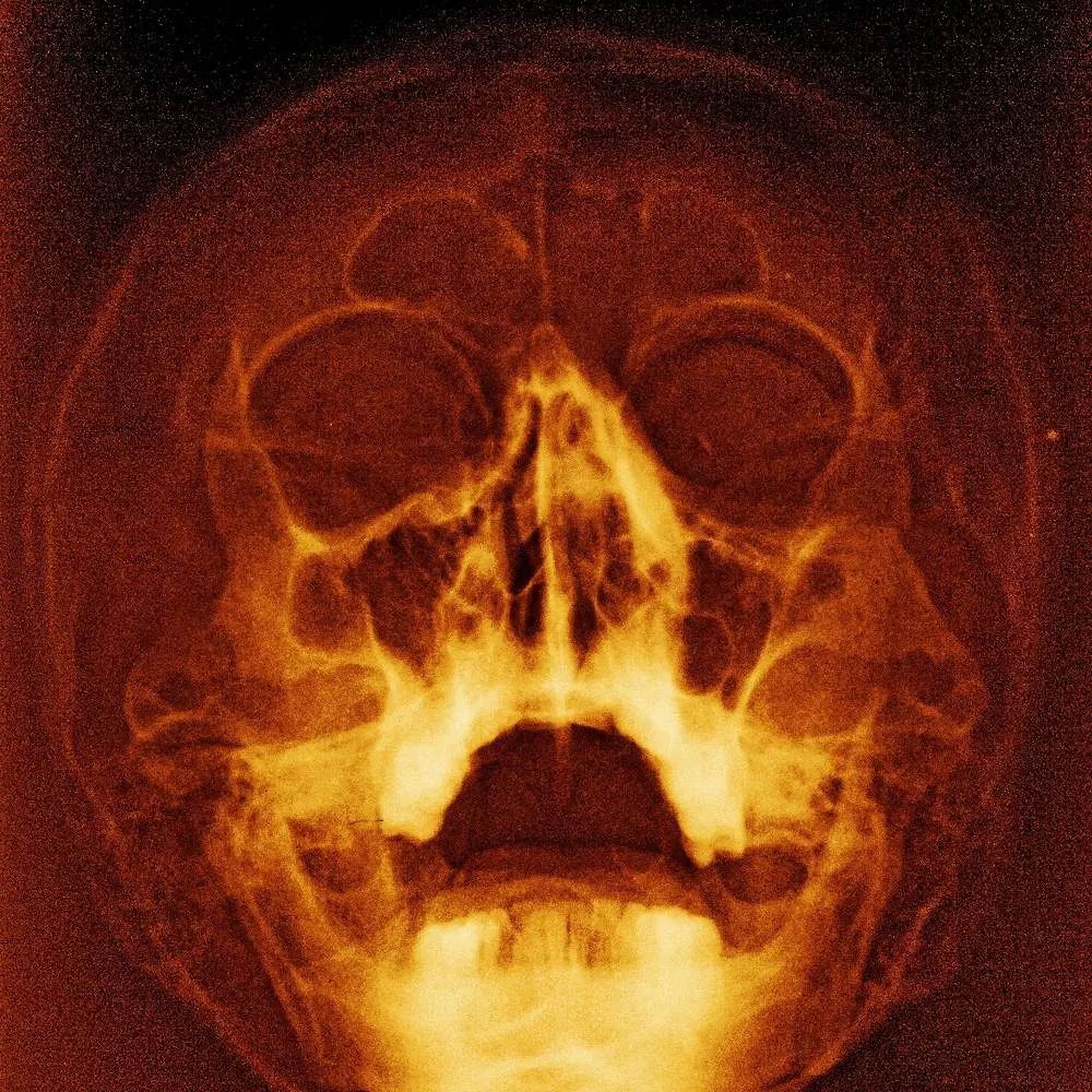 XRay - Teaching in Trips